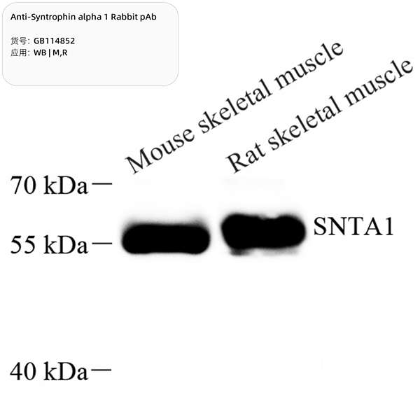 Антитела первичные, поликлональные, Syntrophin alpha 1, 100 мкл