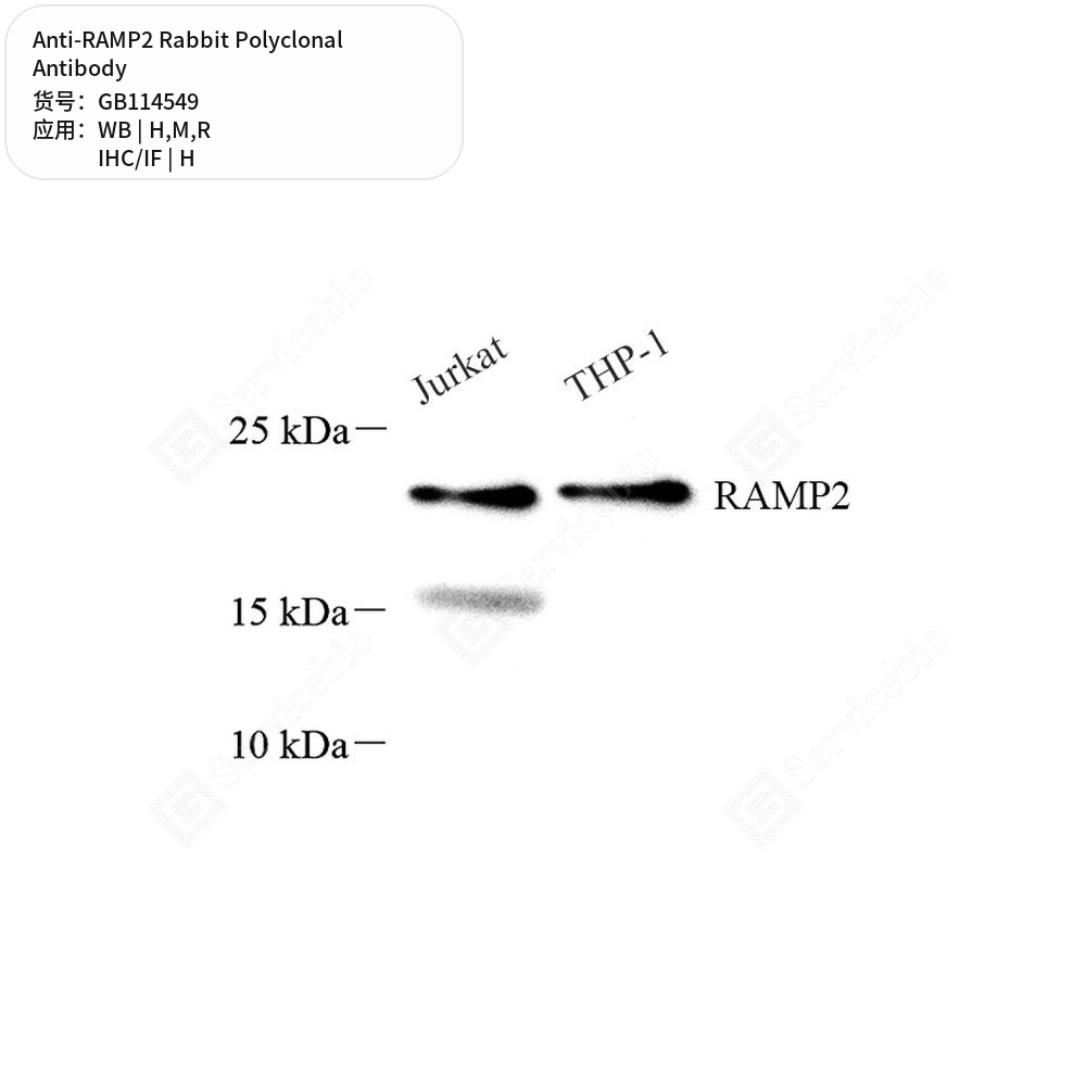 Антитела первичные, поликлональные кролика к RAMP2 крысы, мыши, человека, 100 мкл
