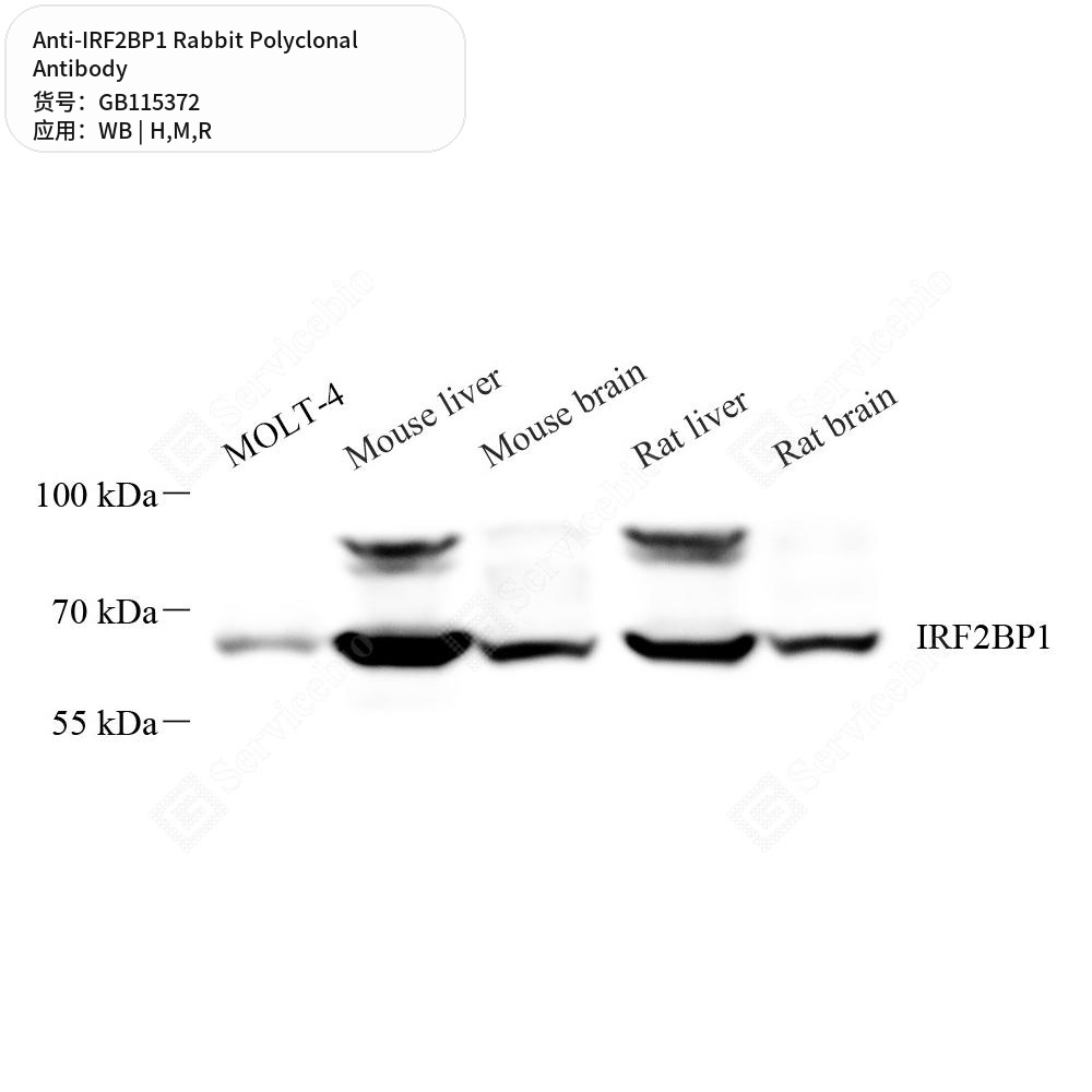 Антитела первичные, поликлональные кролика к IRF2BP1 крысы, мыши, человека, 50 мкл