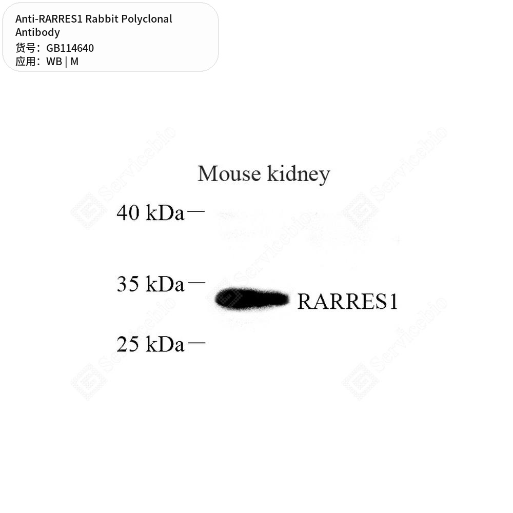 Антитела первичные, поликлональные кролика к RARRES1 мыши, 100 мкл