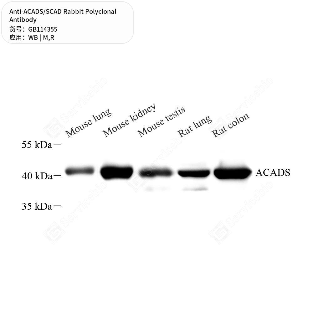 Антитела первичные, поликлональные кролика к ACADS/SCAD крысы, мыши, 100 мкл