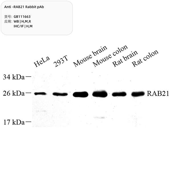 Антитела первичные, поликлональные, RAB21, 100 мкл