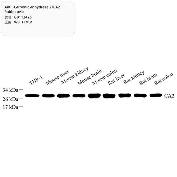 Антитела первичные, поликлональные, Carbonic anhydrase 2/CA2, 100 мкл