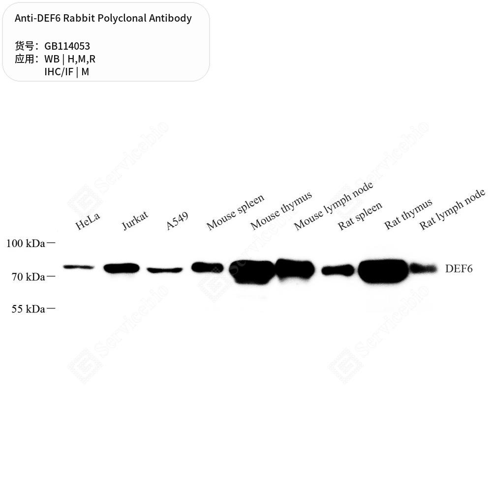 Антитела первичные, поликлональные кролика к DEF6 крысы, мыши, человека, 100 мкл