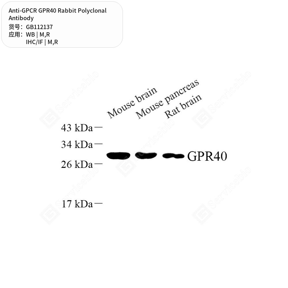 Антитела первичные, поликлональные кролика к GPCR GPR40 крысы, мыши, 100 мкл