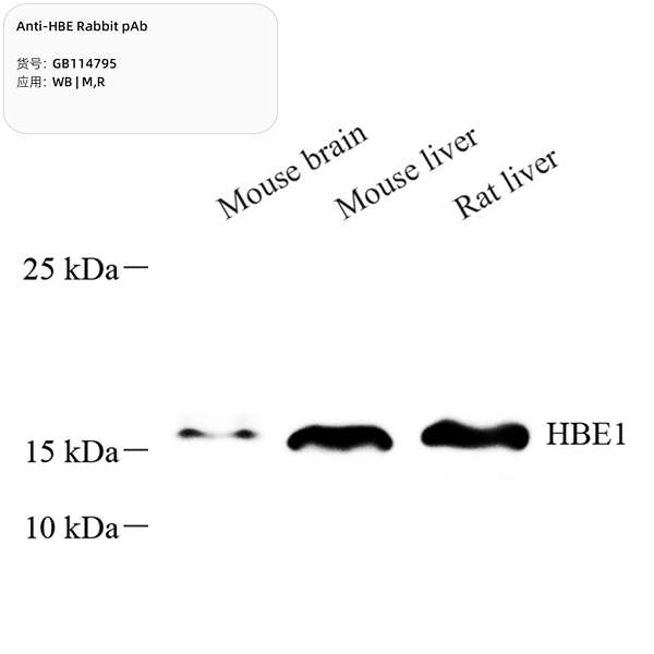 Антитела первичные, поликлональные, HBE, 100 мкл