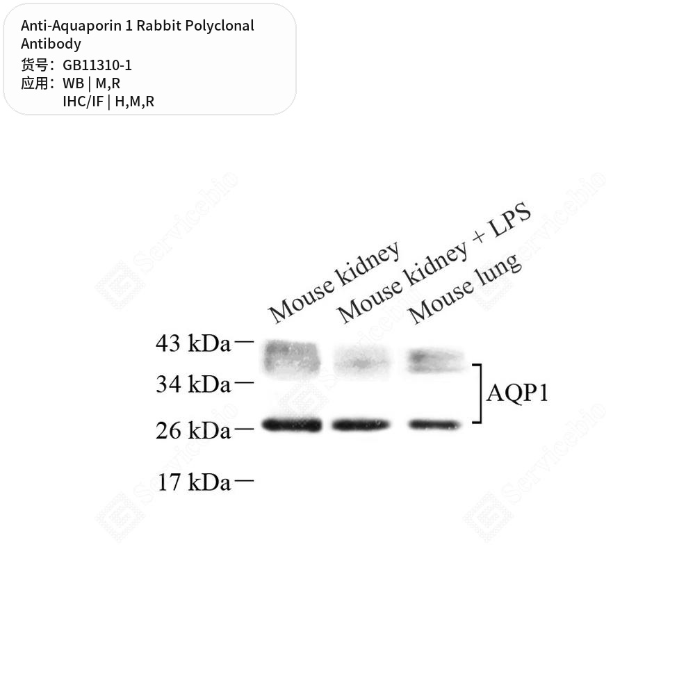Антитела первичные, поликлональные кролика к Aquaporin 1 крысы, мыши, человека, 100 мкл
