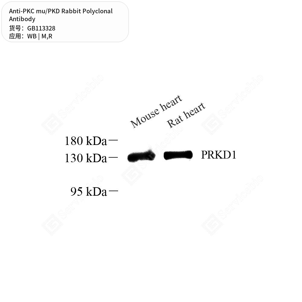 Антитела первичные, поликлональные кролика к PKC mu/PKD крысы, мыши, 50 мкл