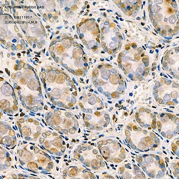 Антитела первичные, поликлональные, ULH1, 100 мкл