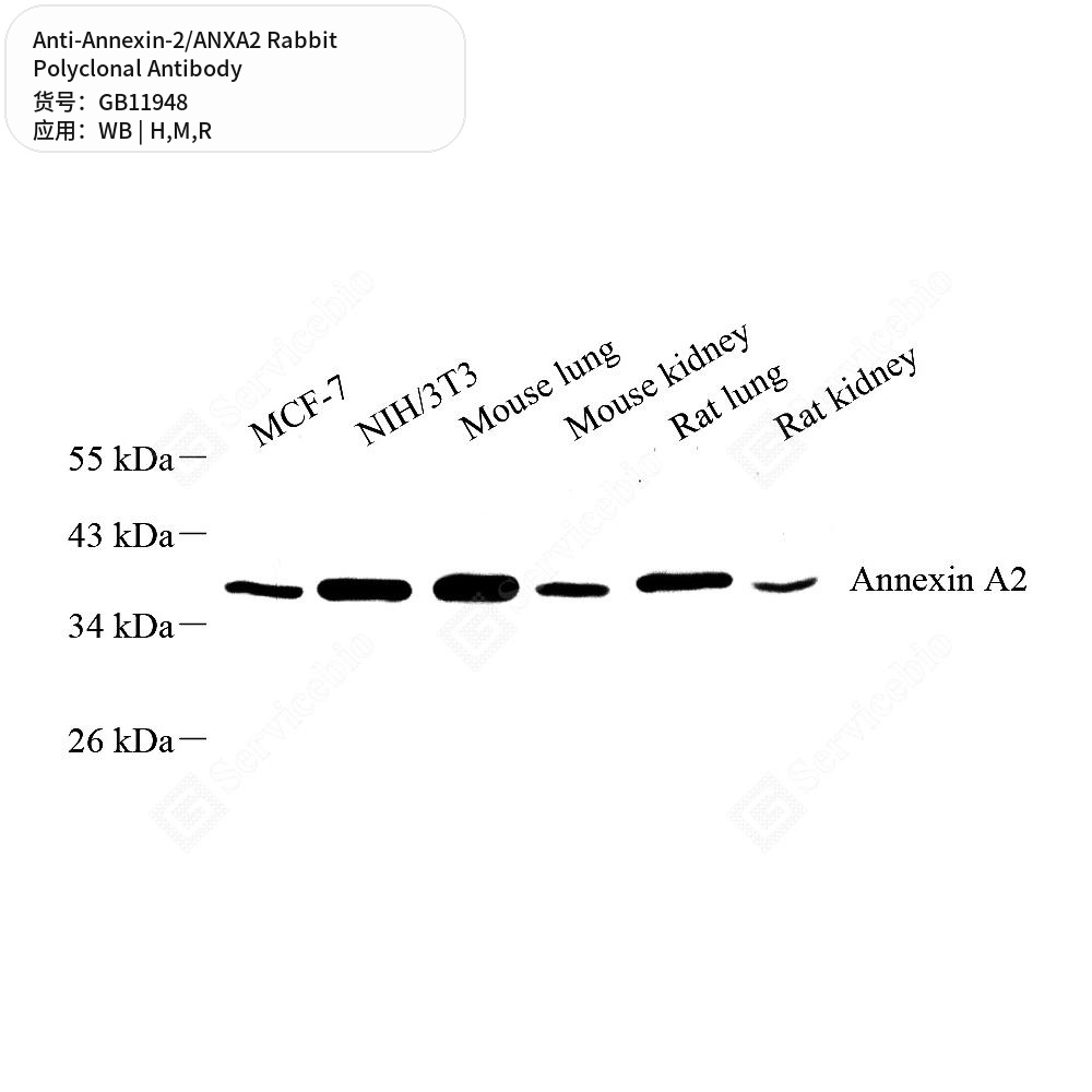 Антитела первичные, поликлональные кролика к Annexin-2/ANXA2 крысы, мыши, человека, 50 мкл