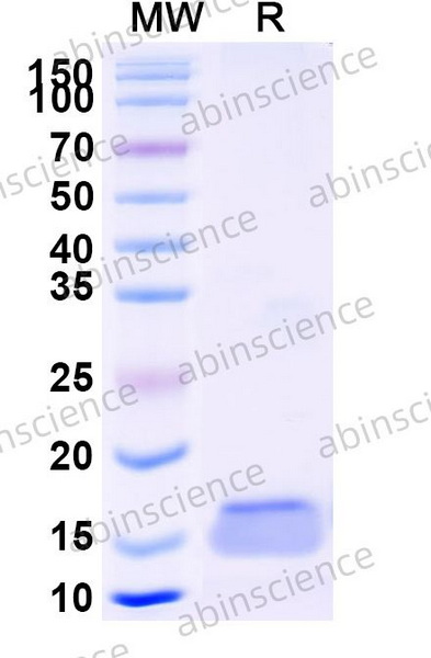 Наноантитела CD340/ERBB2/HER2 (SAA0836), 100 мкг