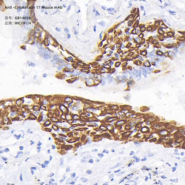 Антитела первичные, моноклональные, Cytokeratin 17, 50 мкл