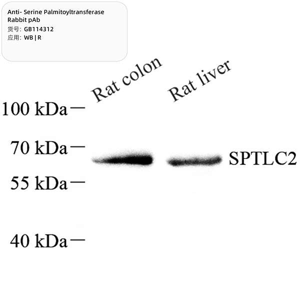 Антитела первичные, поликлональные, Serine Palmitoyltransferase, 100 мкл