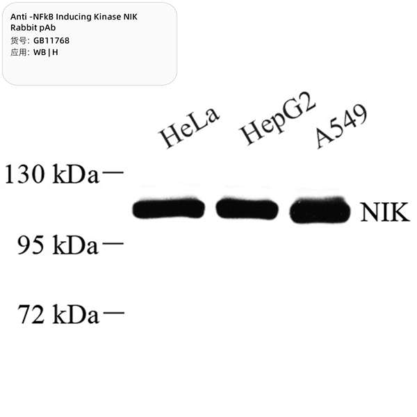 Антитела первичные, поликлональные, NFkB Inducing Kinase NIK, 100 мкл