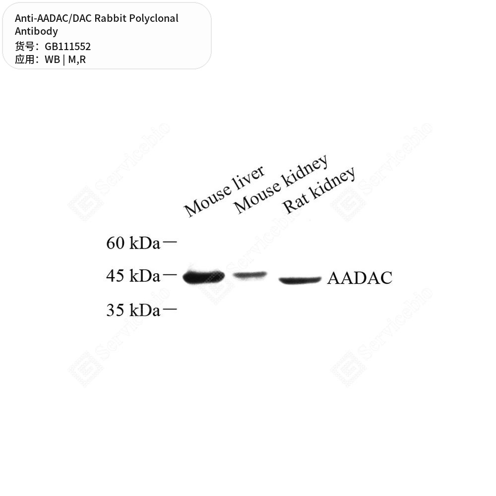 Антитела первичные, поликлональные кролика к AADAC/DAC крысы, мыши, 100 мкл