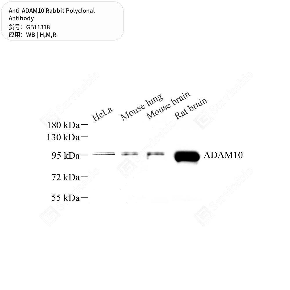 Антитела первичные, поликлональные кролика к ADAM10 крысы, мыши, человека, 50 мкл