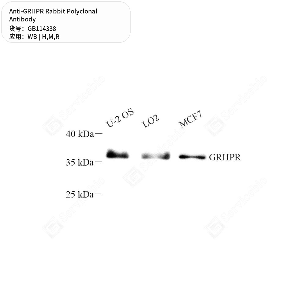 Антитела первичные, поликлональные кролика к GRHPR крысы, мыши, человека, 50 мкл