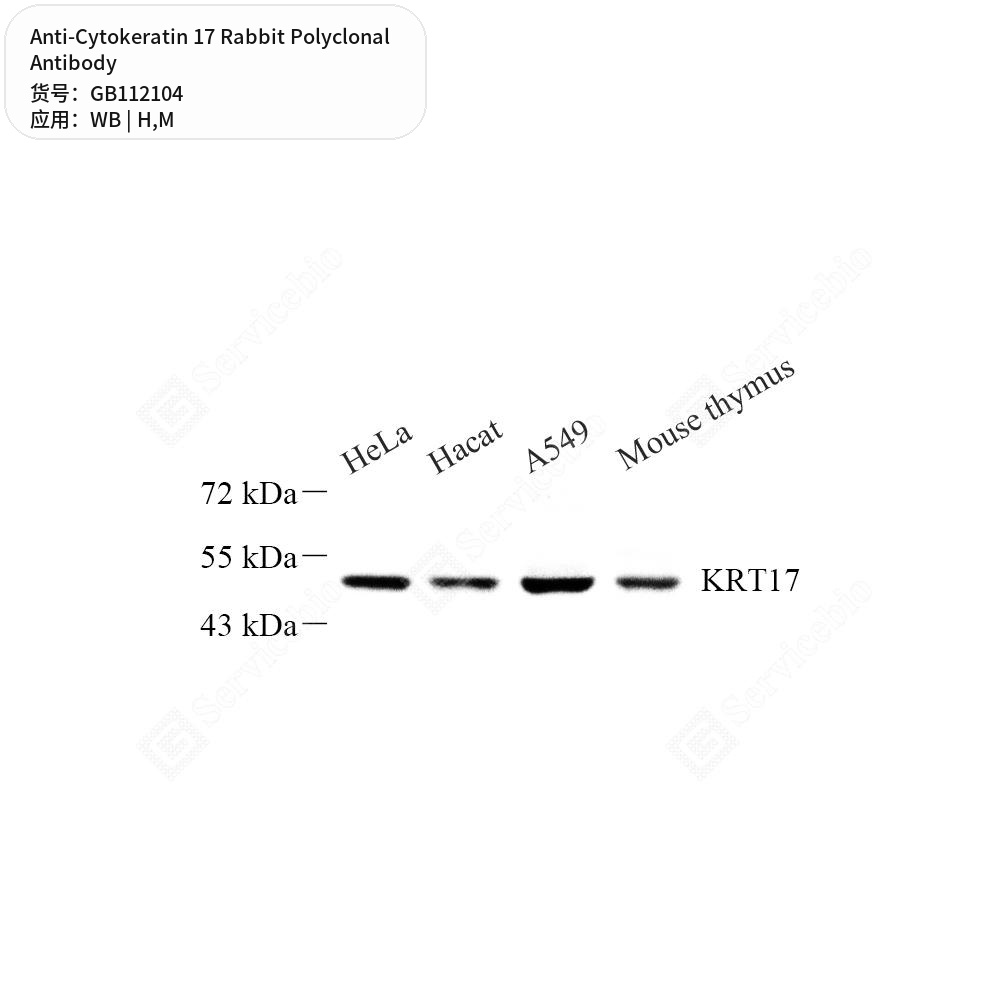 Антитела первичные, поликлональные кролика к Cytokeratin 17 мыши, человека, 100 мкл