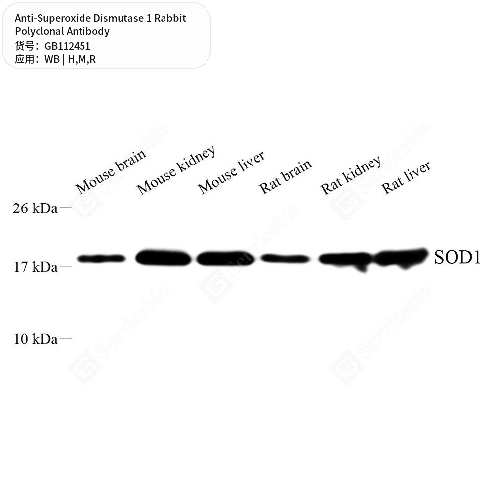 Антитела первичные, поликлональные кролика к Superoxide Dismutase 1 крысы, мыши, человека, 100 мкл