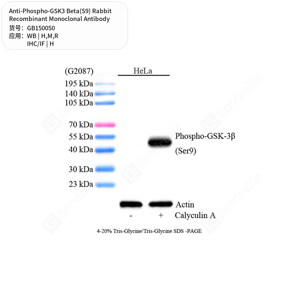 Антитела первичные, моноклональные кролика к Phospho-GSK3 Beta(S9) крысы, мыши, человека, 50 мкл