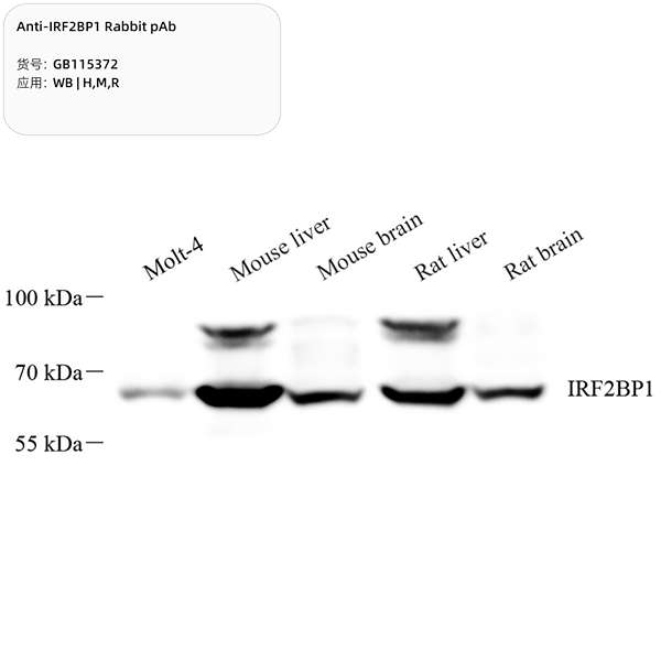 Антитела первичные, поликлональные, IRF2BP1, 100 мкл