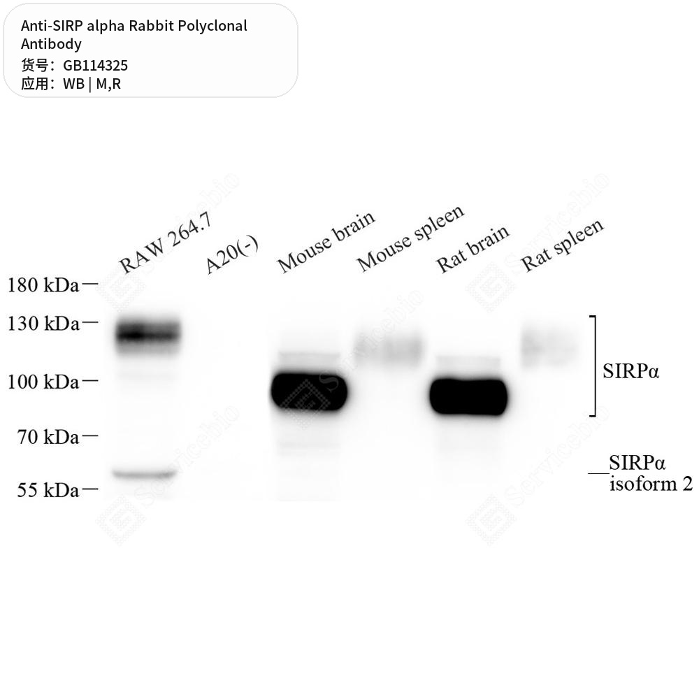 Антитела первичные, поликлональные кролика к SIRP alpha крысы, мыши, 50 мкл
