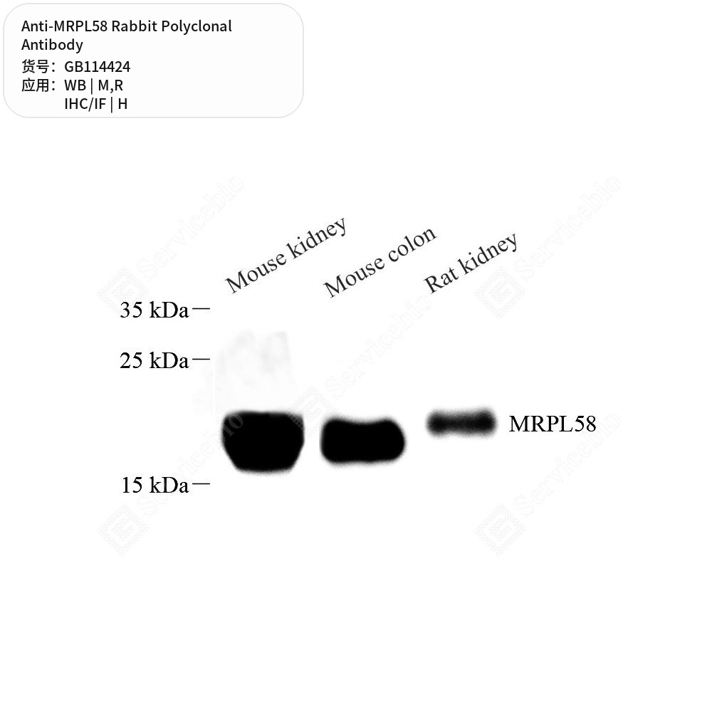 Антитела первичные, поликлональные кролика к MRPL58 крысы, мыши, человека, 100 мкл