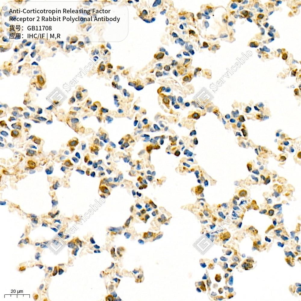 Антитела первичные, поликл. кролика к Corticotropin Releasing Factor Receptor 2 крысы, мыши, 50 мкл
