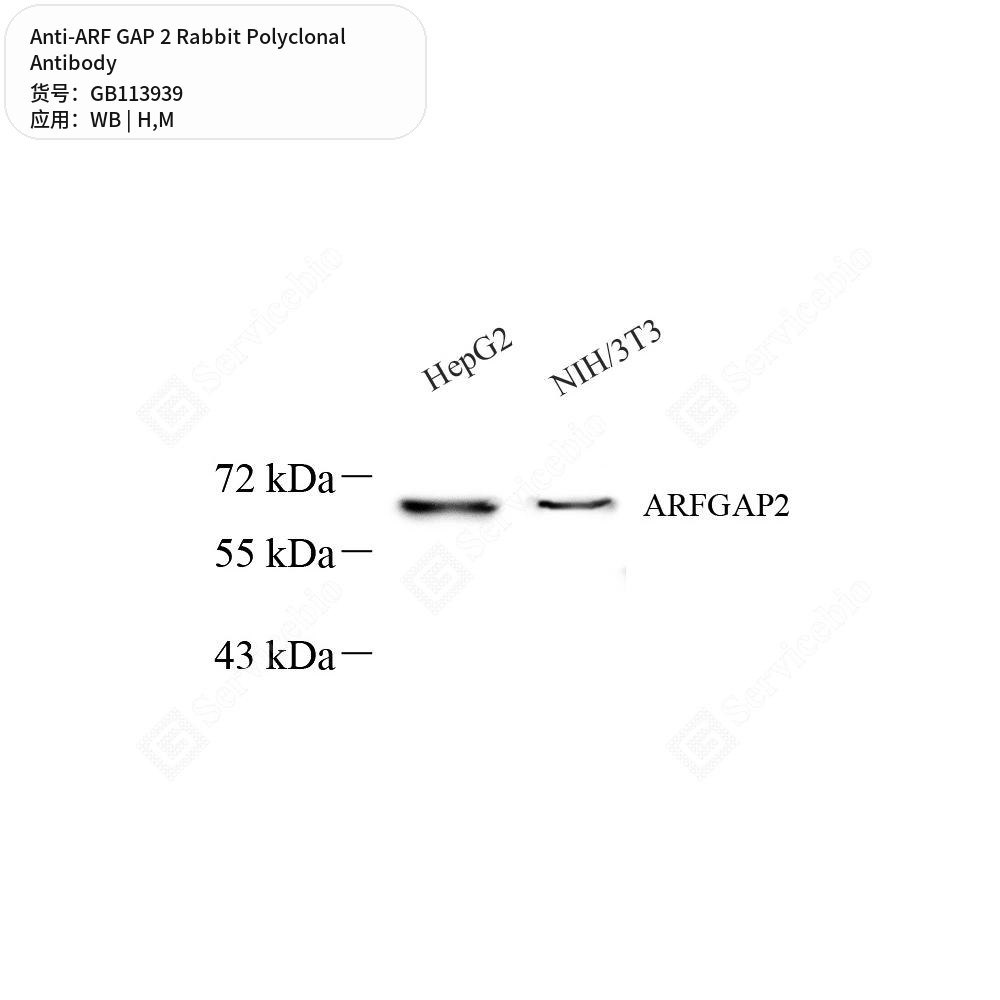 Антитела первичные, поликлональные кролика к ARF GAP 2 мыши, человека, 50 мкл