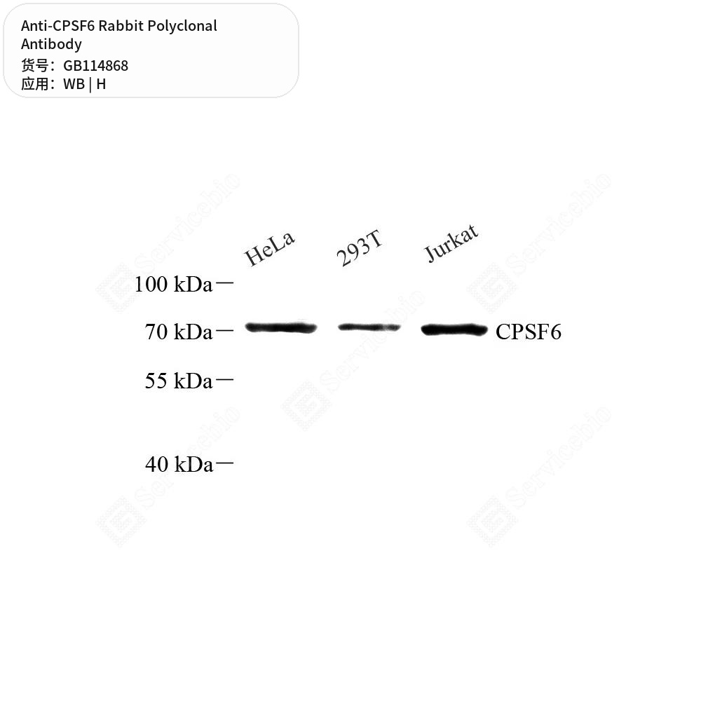 Антитела первичные, поликлональные кролика к CPSF6 человека, 50 мкл