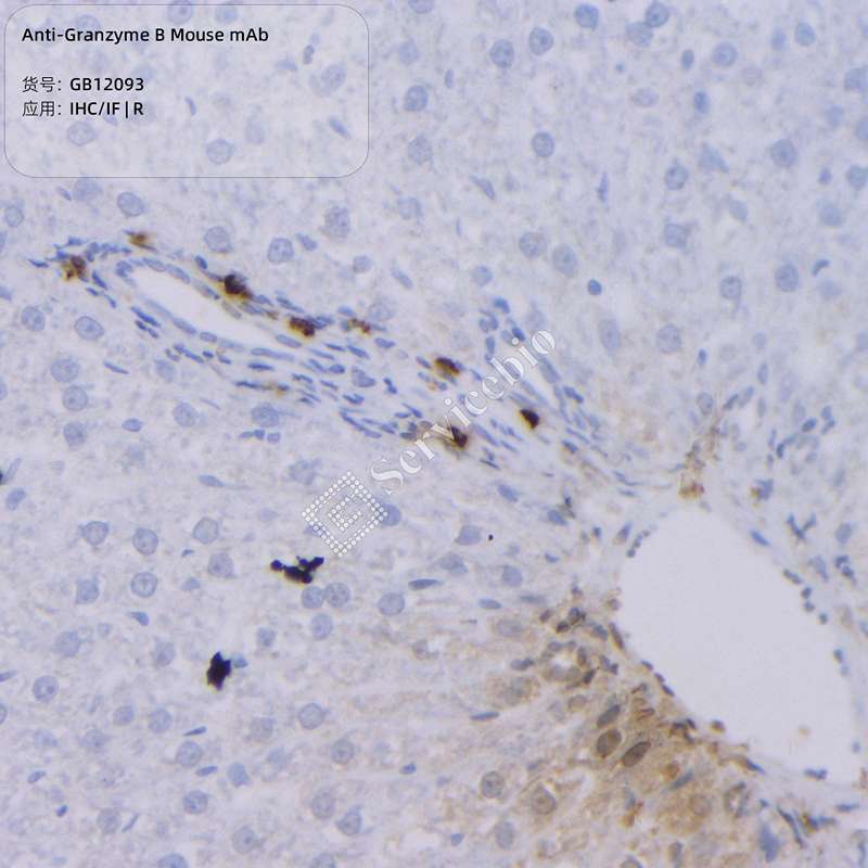 Антитела первичные, моноклональные, Granzyme B, 100 мкл