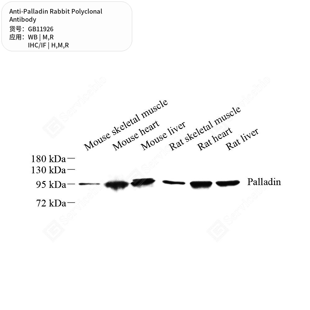 Антитела первичные, поликлональные кролика к Palladin крысы, мыши, человека, 50 мкл
