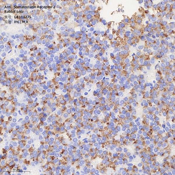 Антитела первичные, поликлональные, Somatostatin Receptor 2, 100 мкл