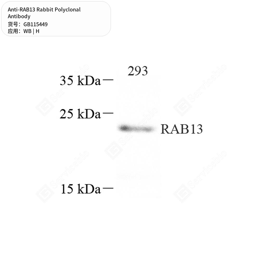 Антитела первичные, поликлональные кролика к RAB13 человека, 100 мкл