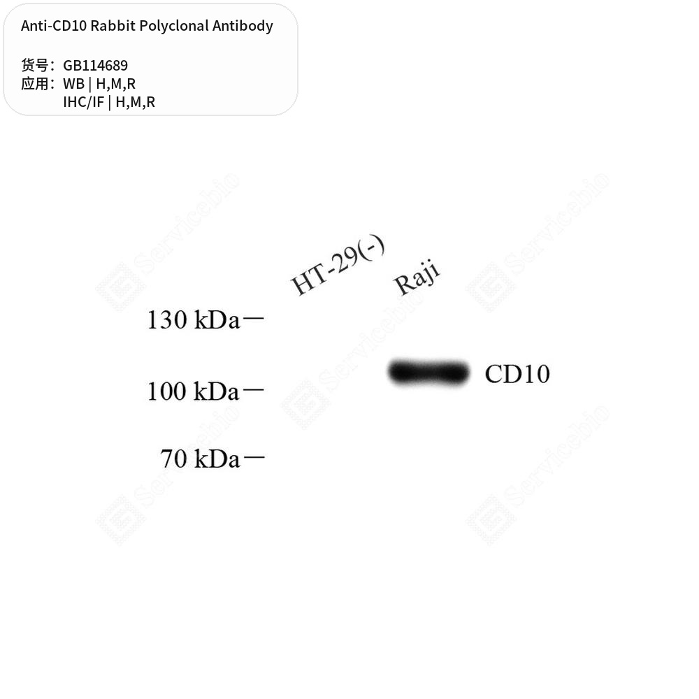 Антитела первичные, поликлональные кролика к CD10 крысы, мыши, человека, 50 мкл