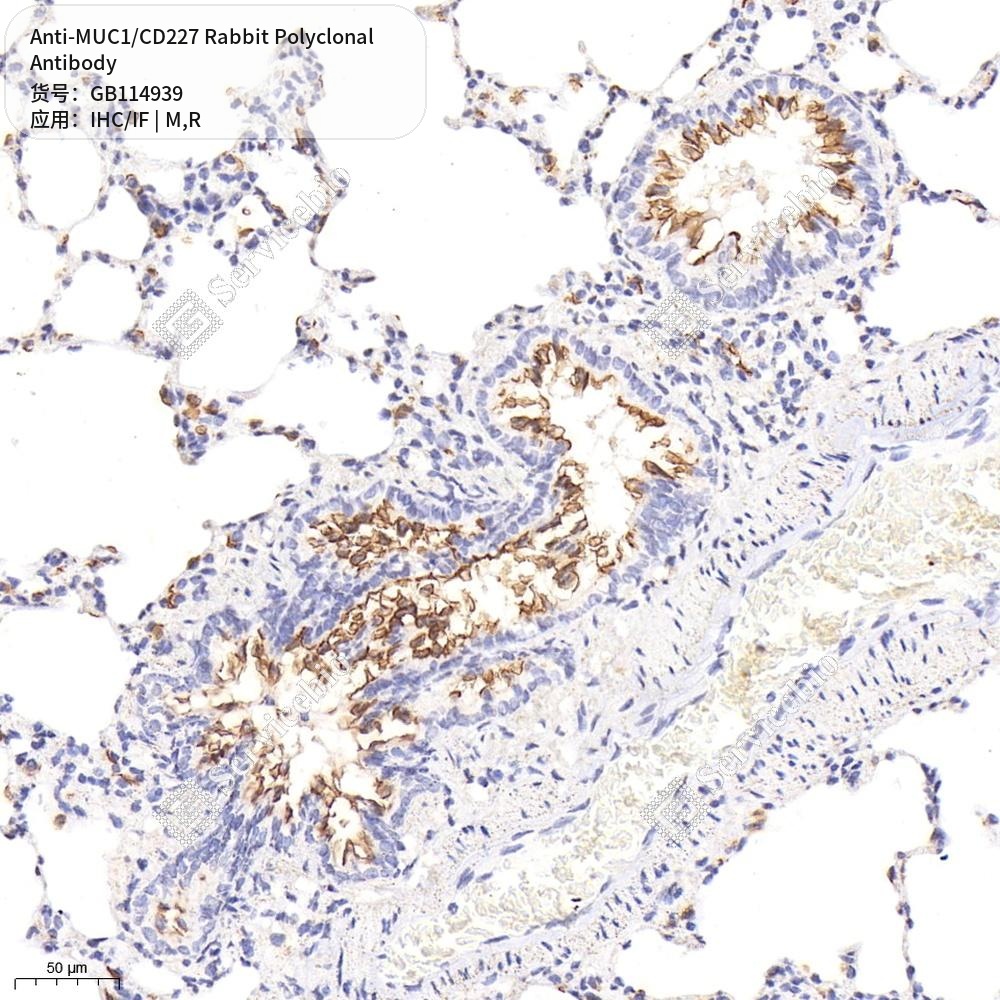 Антитела первичные, поликлональные кролика к MUC1/CD227 крысы, мыши, 50 мкл