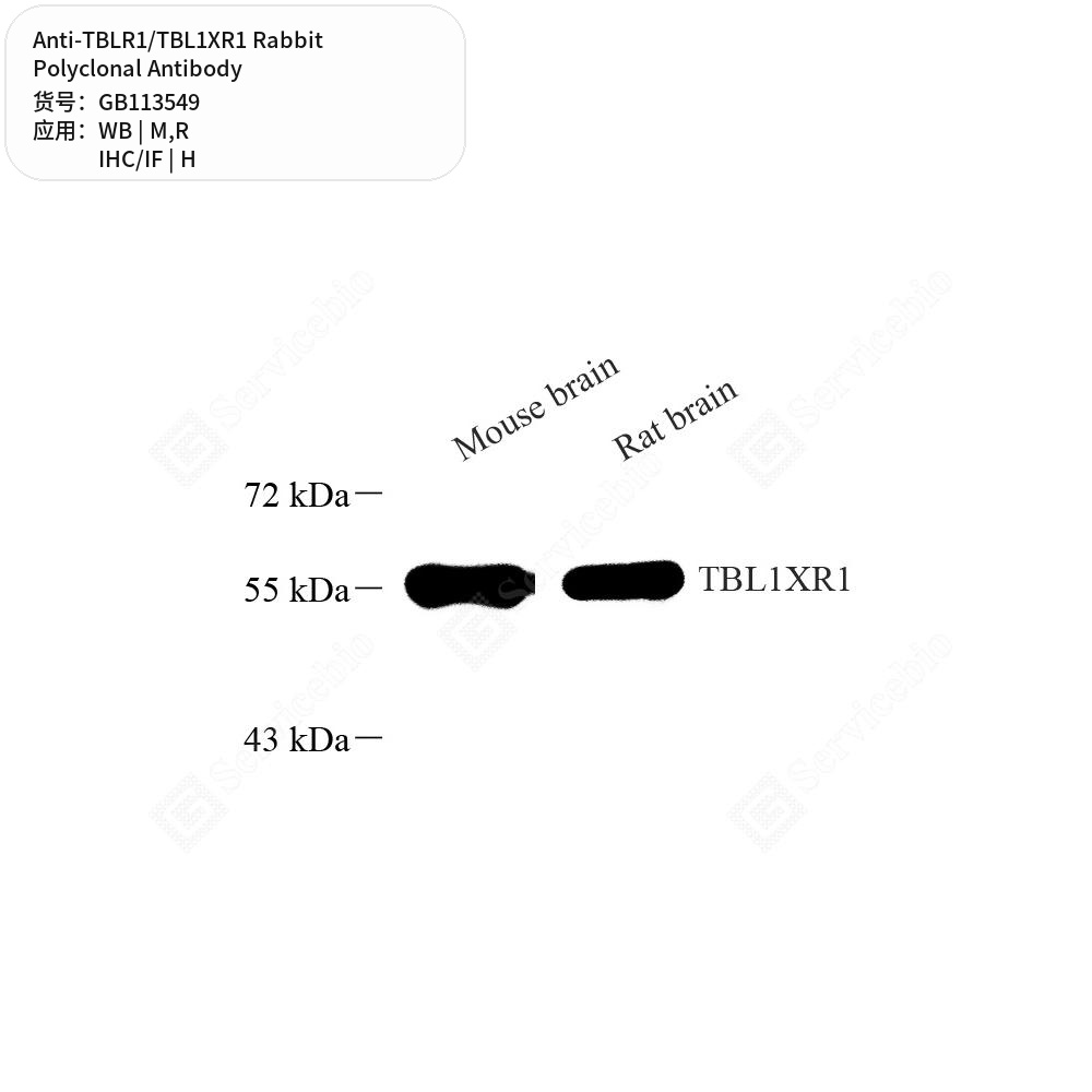 Антитела первичные, поликлональные кролика к TBLR1/TBL1XR1 крысы, мыши, человека, 50 мкл