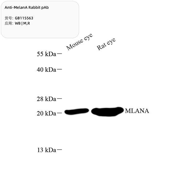 Антитела первичные, поликлональные, MelanA, 100 мкл