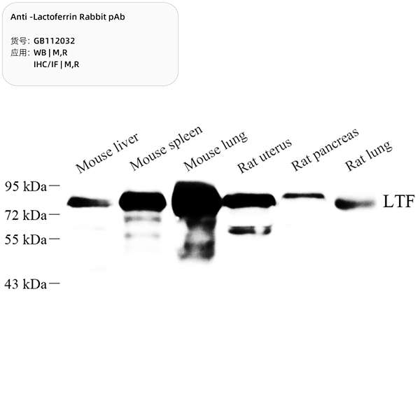 Антитела первичные, поликлональные, Lactoferrin, 100 мкл