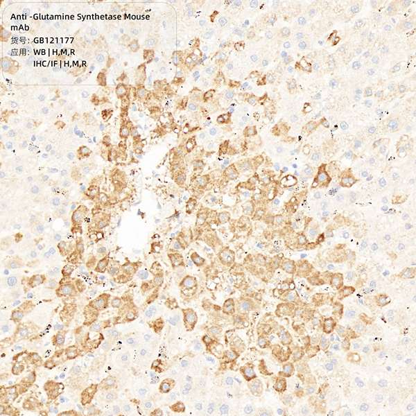 Антитела первичные, моноклональные, Glutamine Synthetase, 100 мкл