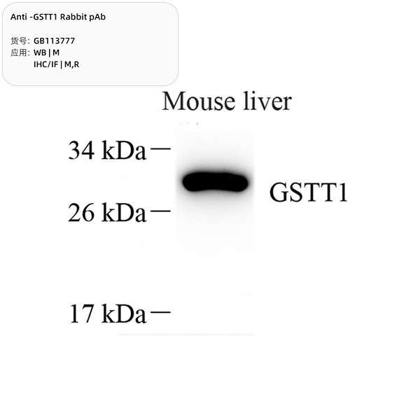 Антитела первичные, поликлональные, GSTT1, 100 мкл