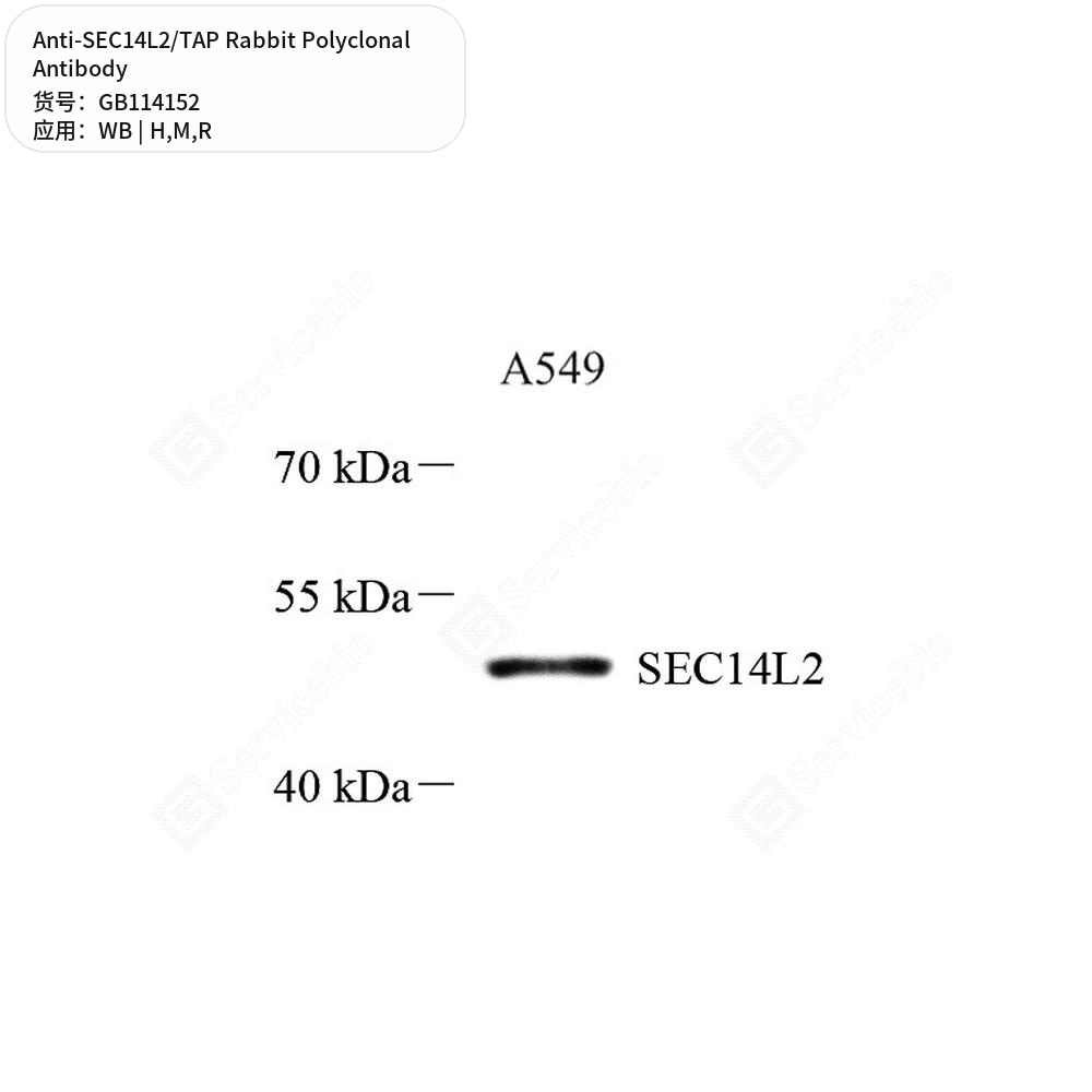 Антитела первичные, поликлональные кролика к SEC14L2/TAP крысы, мыши, человека, 50 мкл