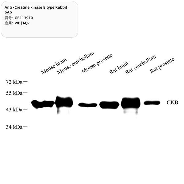 Антитела первичные, поликлональные, Creatine kinase B type, 100 мкл