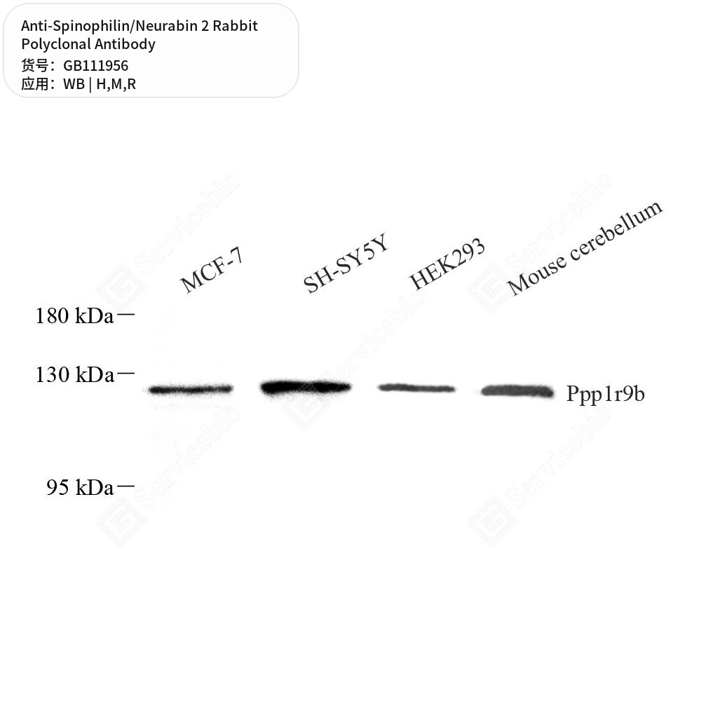 Антитела первичные, поликлональные кролика к Spinophilin/Neurabin 2 крысы, мыши, человека, 100 мкл