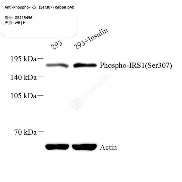 Антитела первичные, поликлональные, Phospho-IRS1 (Ser307), 100 мкл