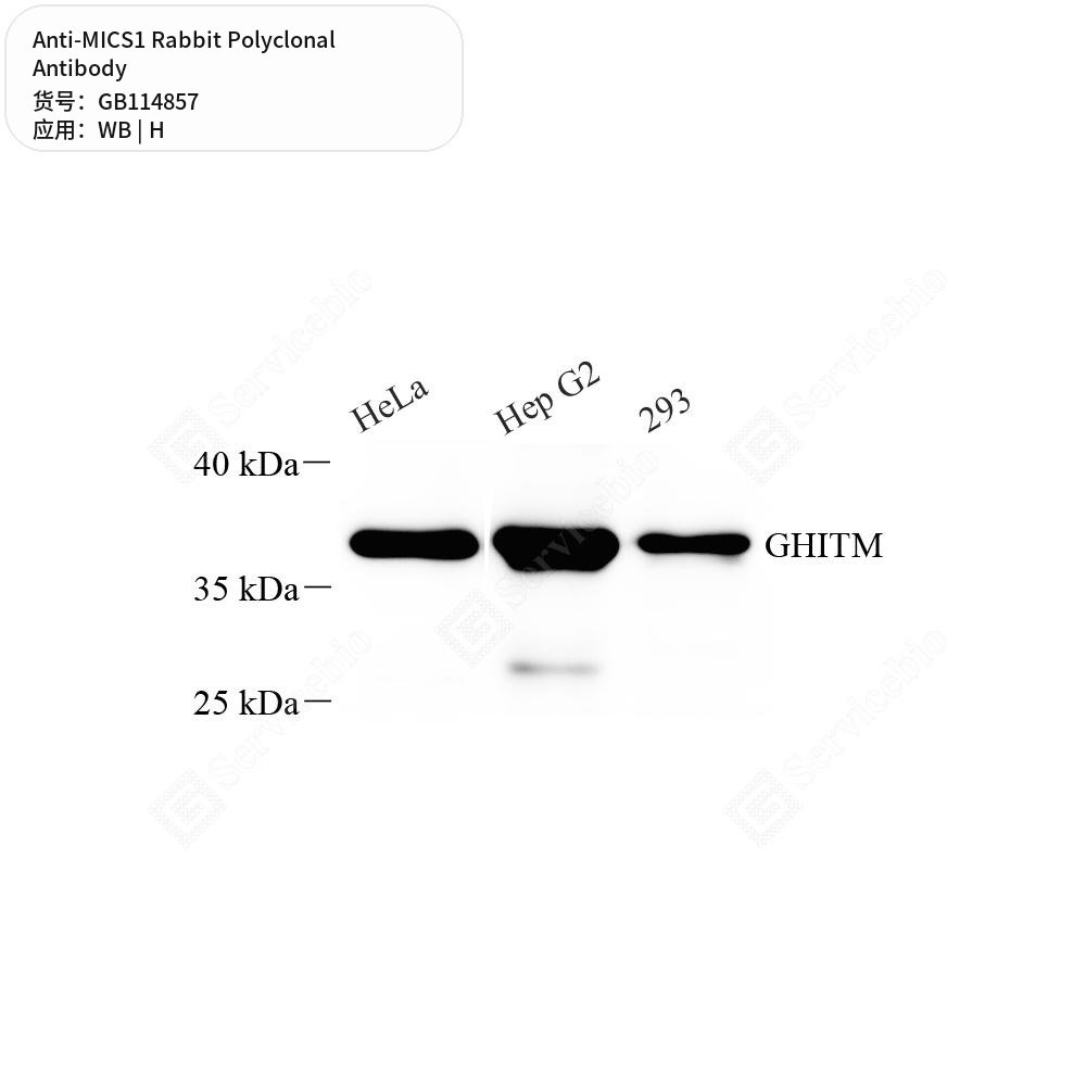 Антитела первичные, поликлональные кролика к MICS1 человека, 100 мкл