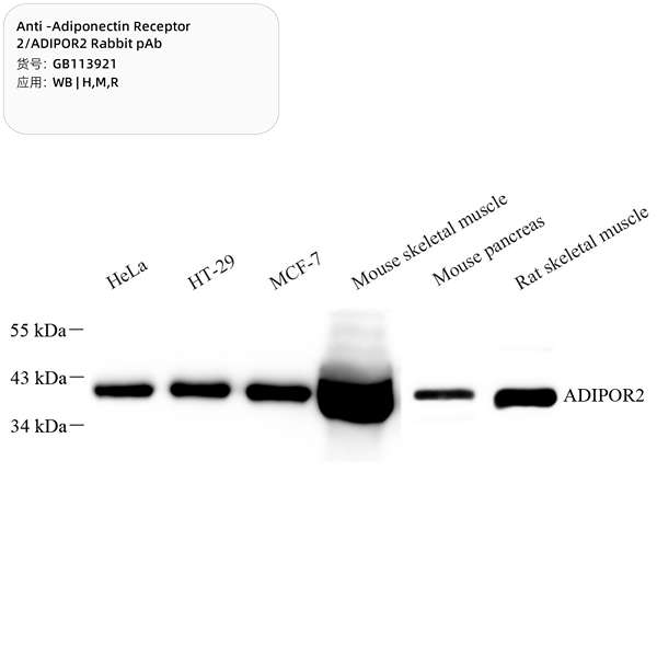 Антитела первичные, поликлональные, Adiponectin Receptor 2/ADIPOR2, 100 мкл