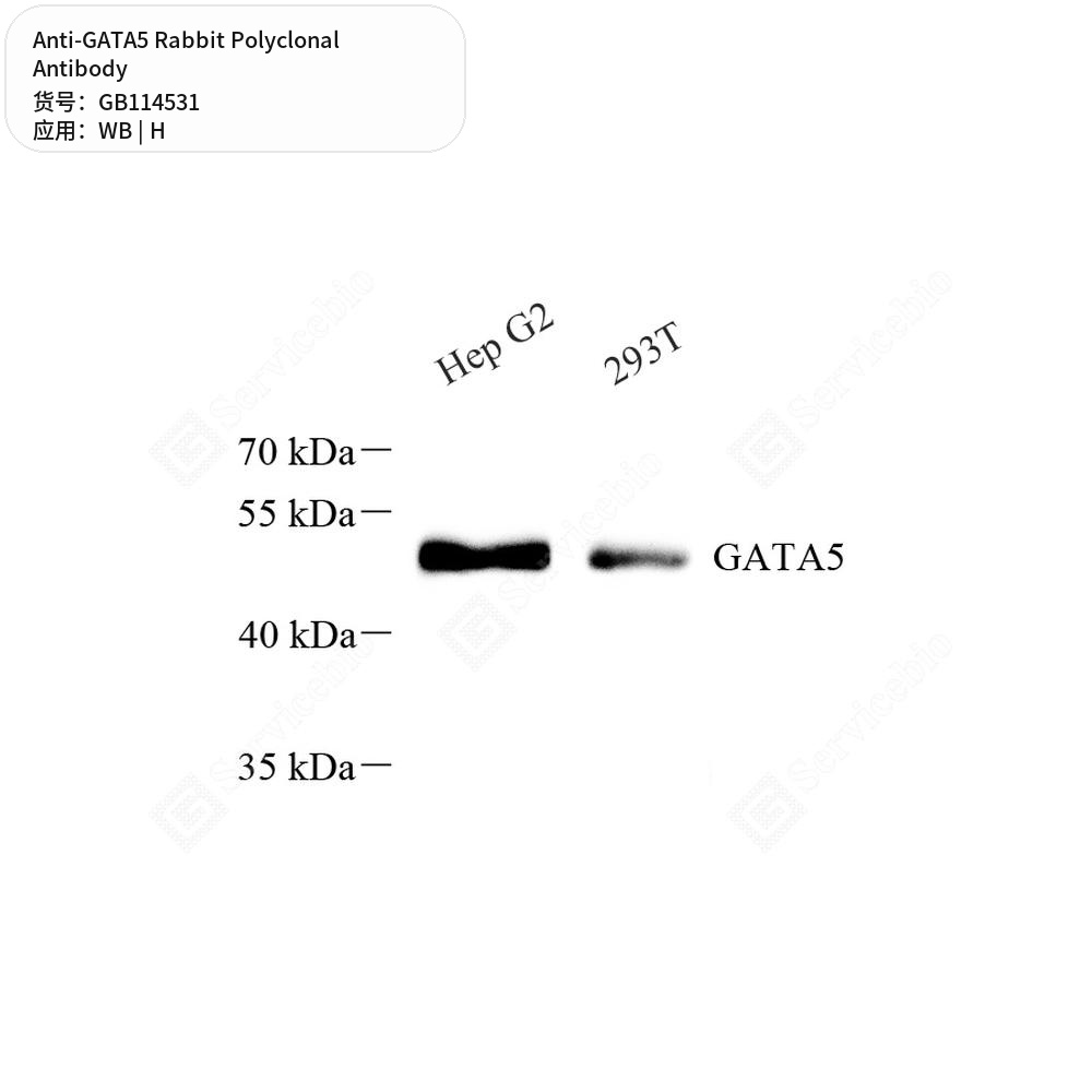 Антитела первичные, поликлональные кролика к GATA5 человека, 50 мкл