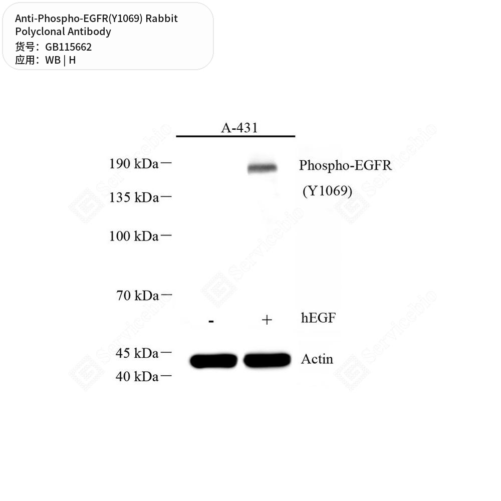 Антитела первичные, поликлональные кролика к Phospho-EGFR(Y1069) человека, 50 мкл