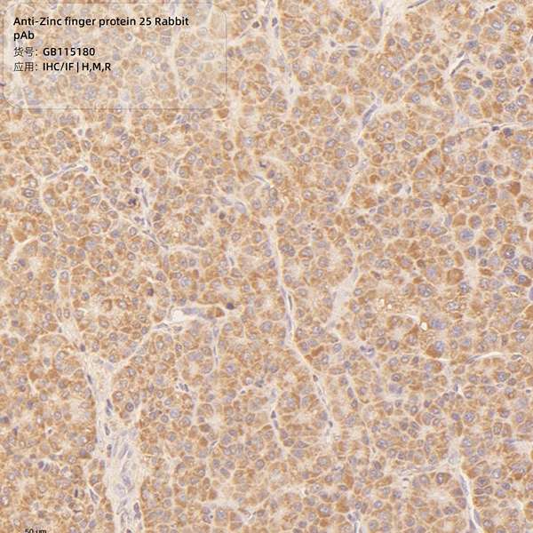Антитела первичные, поликлональные, Zinc finger protein 25, 100 мкл